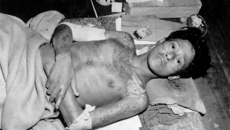 80 Yıl Sonra Nagasaki’den Dikkat Çeken Uyarı: Nükleer Felaket Tehlikesi!