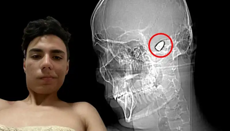 Kafasında Patlayıcı Var: Psikolojik Sorunlar ve Çözümleri